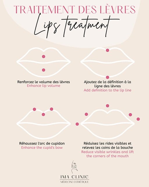 Realisation IMA Clinic Post7